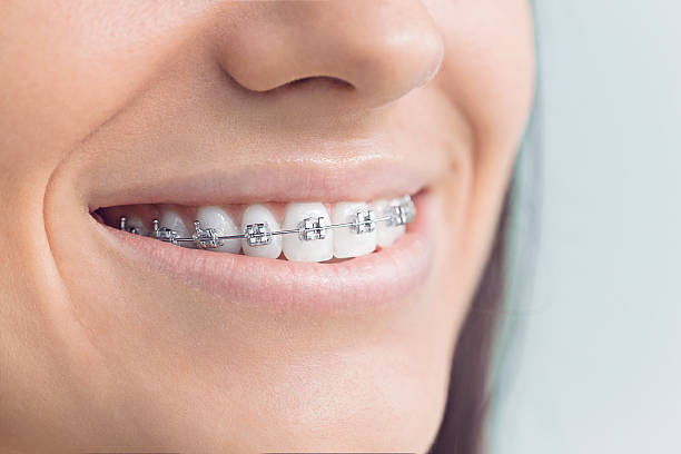 Best Veneers and Lumineers  in Buena Park, CA